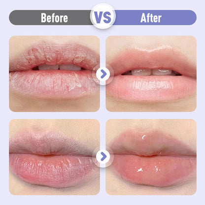 💕Zahusťujúce a vyhladzujúce hydratačné sérum na pery