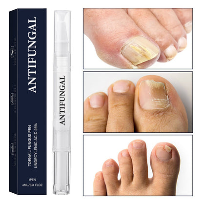 Pero na ošetrenie nechtovej plesne na poškodené nechty